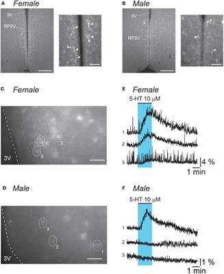 Serotonin stimulates female preoptic area kisspeptin neurons via activation of type 2 serotonin receptors in mice